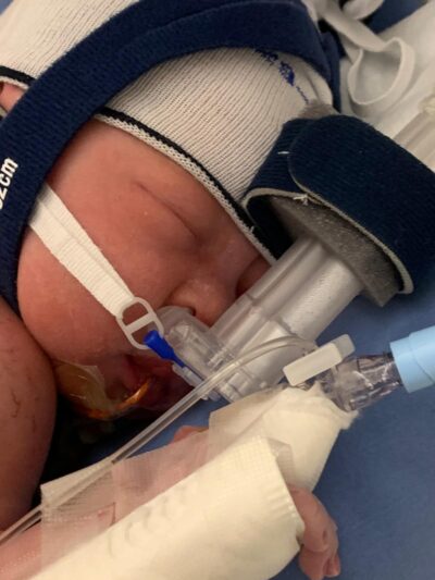 Bubble, CPAP, NICU baby,IV